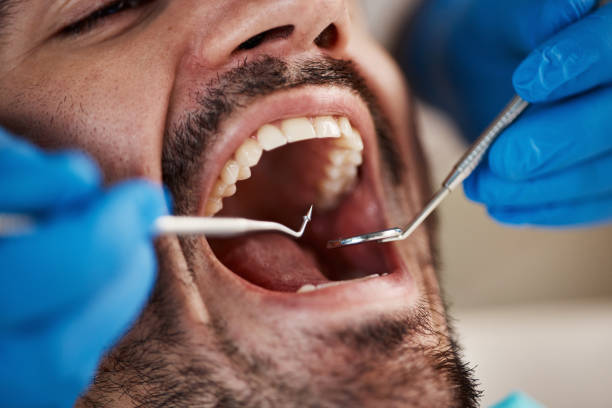 Best Emergency Dental Care for Broken or Chipped Teeth in Dana, NC